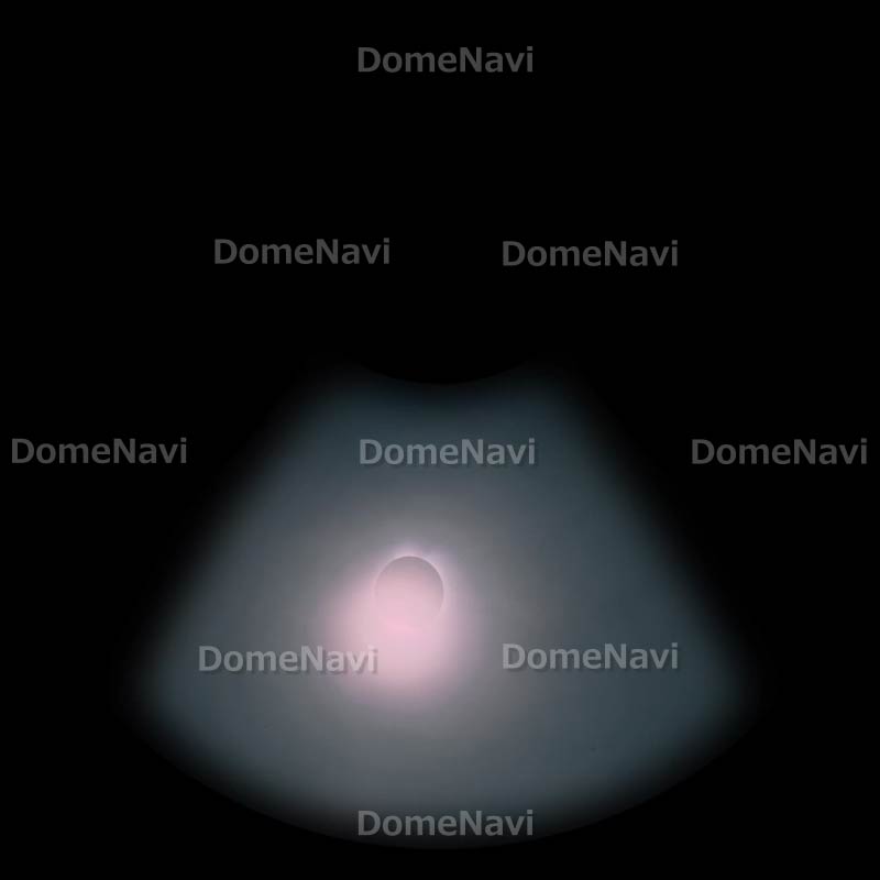 皆既日食　コロナ　1991年ハワイ皆既日食